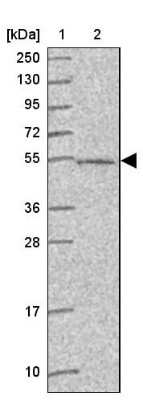 Western Blot: ABHD18 Antibody [NBP2-30555]