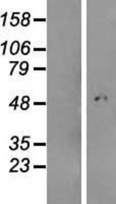 Western Blot: ABHD18 Overexpression Lysate [NBL1-08470]