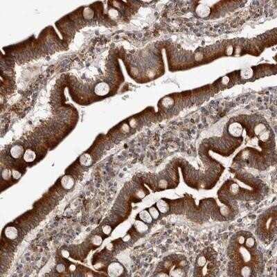 Immunohistochemistry-Paraffin: C4orf3 Antibody [NBP1-91047]