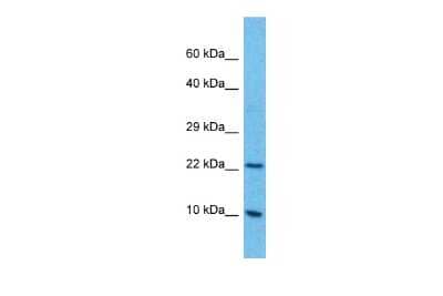 Western Blot: C4orf3 Antibody [NBP2-82908]