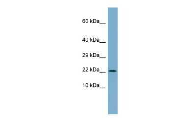 Western Blot: C4orf3 Antibody [NBP2-82915]