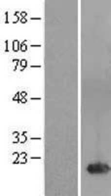 Western Blot: FAM241A Overexpression Lysate [NBL1-08473]