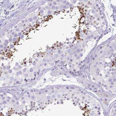 Immunohistochemistry-Paraffin: C4orf33 Antibody [NBP2-32585]