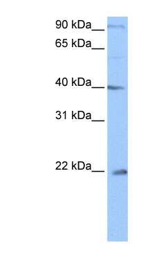 Western Blot: C4orf33 Antibody [NBP1-57846]