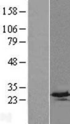 Western Blot: C4orf33 Overexpression Lysate [NBL1-08474]