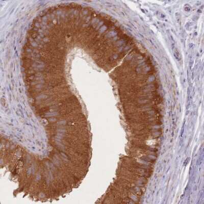 Immunohistochemistry-Paraffin: SMIM14 Antibody [NBP2-14413]