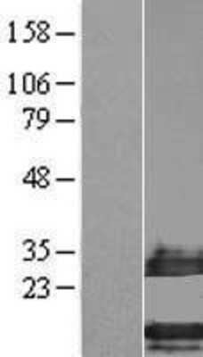 Western Blot: SMIM14 Overexpression Lysate [NBL1-08475]