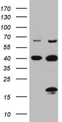 Western Blot: C4orf36 Antibody (OTI7A7) [NBP2-46040]