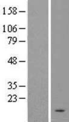 Western Blot: C4orf36 Overexpression Lysate [NBL1-08477]