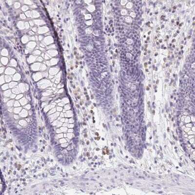 Immunohistochemistry-Paraffin: PRR27 Antibody [NBP1-91001]