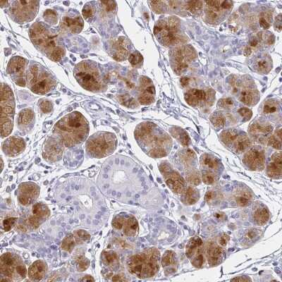 Immunohistochemistry-Paraffin: PRR27 Antibody [NBP1-91001]