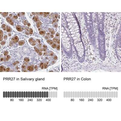 Immunohistochemistry-Paraffin: PRR27 Antibody [NBP1-91001]