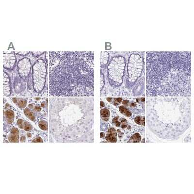 Immunohistochemistry-Paraffin: PRR27 Antibody [NBP1-91001]