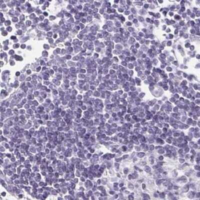 Immunohistochemistry-Paraffin: PRR27 Antibody [NBP1-91001]