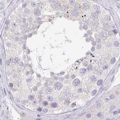 Immunohistochemistry-Paraffin: PRR27 Antibody [NBP1-91001]