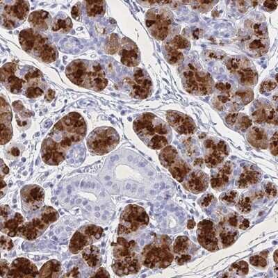 Immunohistochemistry-Paraffin: PRR27 Antibody [NBP2-32719]