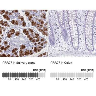 Immunohistochemistry-Paraffin: PRR27 Antibody [NBP2-32719]