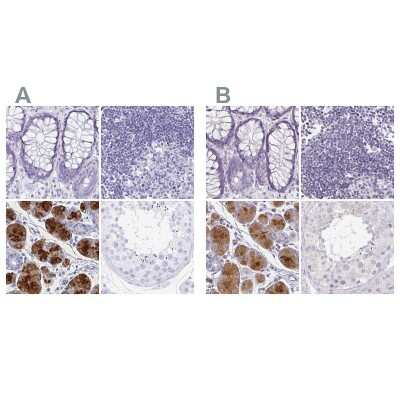 Immunohistochemistry-Paraffin: PRR27 Antibody [NBP2-32719]
