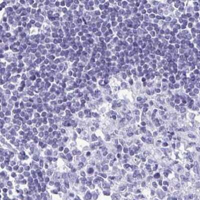 Immunohistochemistry-Paraffin: PRR27 Antibody [NBP2-32719]