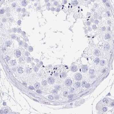 Immunohistochemistry-Paraffin: PRR27 Antibody [NBP2-32719]