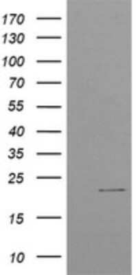 Western Blot: CTBP1-DT Antibody (OTI4F2) [NBP2-45585]