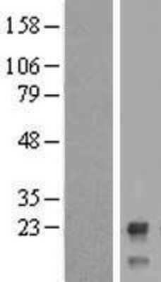 Western Blot: CTBP1-DT Overexpression Lysate [NBP2-05855]