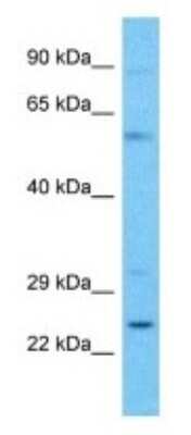 Western Blot: C4orf45 Antibody [NBP3-09655]