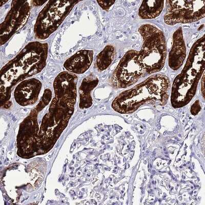 Immunohistochemistry-Paraffin: RCDG1 Antibody [NBP2-14414]