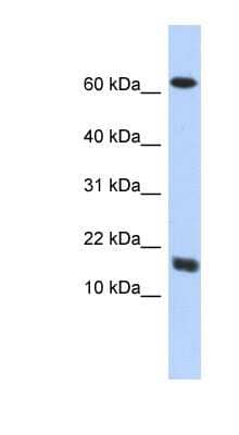 Western Blot: RCDG1 Antibody [NBP1-56427]