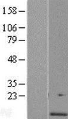 Western Blot: RCDG1 Overexpression Lysate [NBL1-12584]