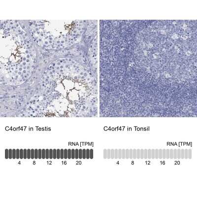 Immunocytochemistry/ Immunofluorescence: C4orf47 Antibody [NBP3-17122]