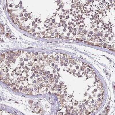 Immunohistochemistry-Paraffin: C4orf47 Antibody [NBP1-93540]