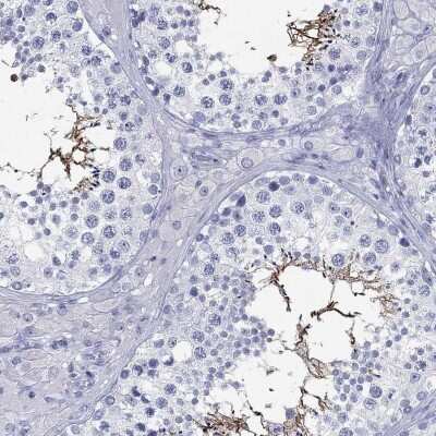 Immunohistochemistry-Paraffin: C4orf47 Antibody [NBP3-17122]