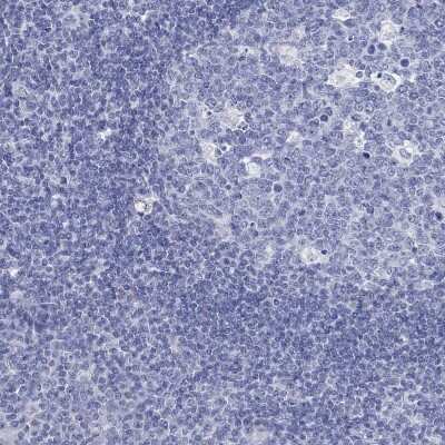 Immunohistochemistry-Paraffin: C4orf47 Antibody [NBP3-17122]