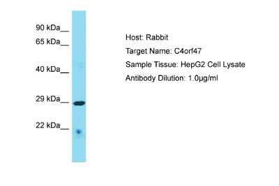 Western Blot: C4orf47 Antibody [NBP2-82916]