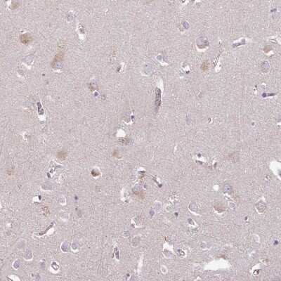 Immunohistochemistry-Paraffin: C4orf48 Antibody [NBP2-30706]