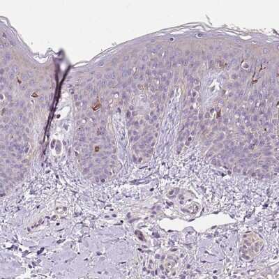 Immunohistochemistry-Paraffin: C4orf48 Antibody [NBP2-30706]