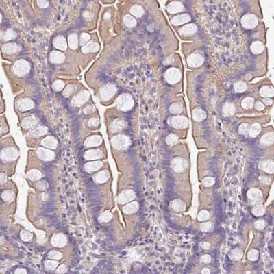 Immunohistochemistry-Paraffin: C4orf48 Antibody [NBP2-30706]