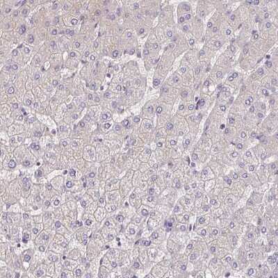Immunohistochemistry-Paraffin: C4orf48 Antibody [NBP2-30706]