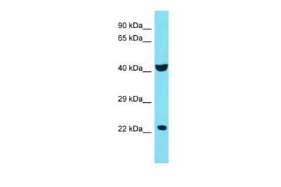 Western Blot: C4orf51 Antibody [NBP3-10763]