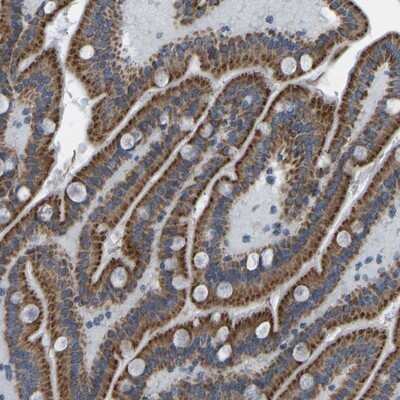 Immunohistochemistry-Paraffin: SMIM20 Antibody [NBP1-90942]
