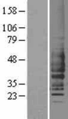 Western Blot: Complement Component C5aR1 Overexpression Lysate [NBL1-08482]