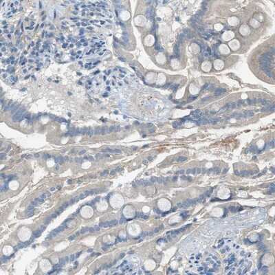 Immunohistochemistry-Paraffin: C5L2/GPR77 Antibody [NBP1-86777]