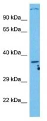 Western Blot: C5L2/GPR77 Antibody [NBP3-10811]