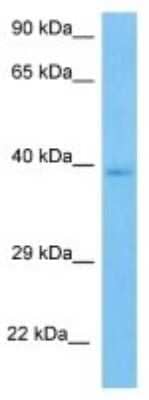 Western Blot: C5L2/GPR77 Antibody [NBP3-10864]