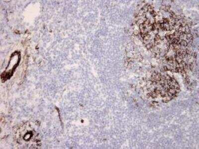 Immunohistochemistry-Frozen: C5b-9 Antibody (aE11) - BSA Free [NBP1-05120]