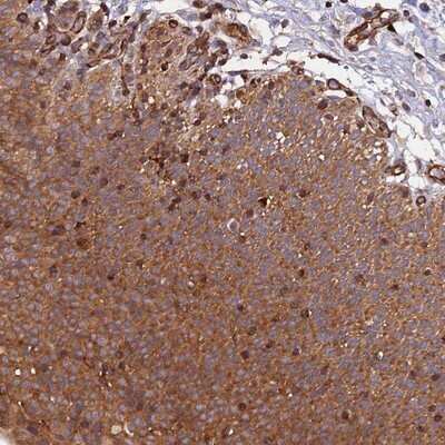 Immunohistochemistry-Paraffin: C5orf22 Antibody [NBP1-83769]