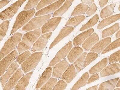 Immunohistochemistry-Paraffin: C5orf22 Antibody [NBP2-98180]