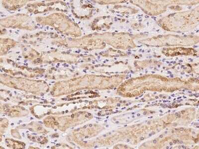 Immunohistochemistry-Paraffin: C5orf22 Antibody [NBP2-98180]