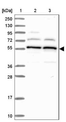 Western Blot: C5orf22 Antibody [NBP1-83769]